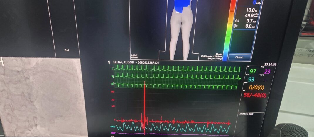 Nouă pacienți cu probleme cardiace serioase au beneficiat de intervenții salvatoare, la Spitalul Slatina