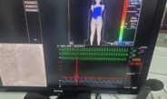 Nouă pacienți cu probleme cardiace serioase au beneficiat de intervenții salvatoare, la Spitalul Slatina