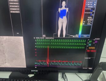 Nouă pacienți cu probleme cardiace serioase au beneficiat de intervenții salvatoare, la Spitalul Slatina